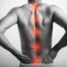 ¿Dolor de espalda que no desaparece? Podría ser Espondilitis Anquilosante