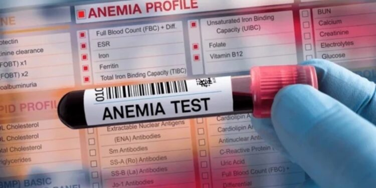 Tratar a tiempo la deficiencia de hierro, podría reducir la mortalidad materno infantil