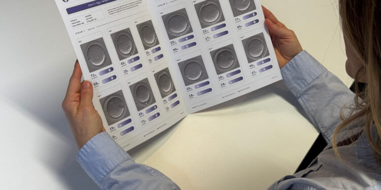 Año nuevo, nuevas opciones: cómo la congelación de óvulos y la IA están guiando decisiones hacia 2026