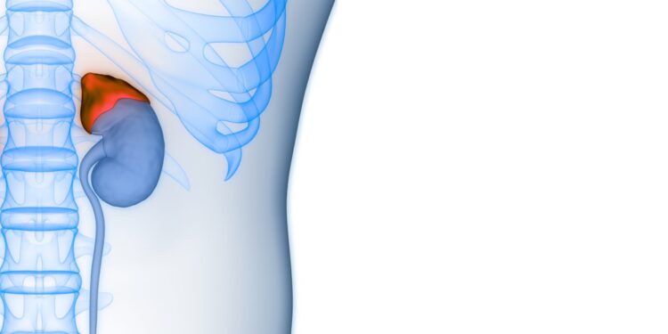 La nueva era en cirugía de cáncer suprarrenal con tecnología robótica de última generación