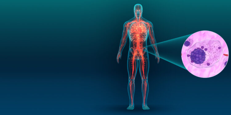 Un nuevo blanco terapéutico contra el mieloma múltiple: el rol del colesterol y el hierro