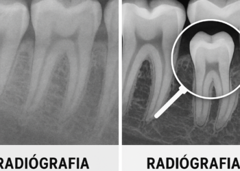 Dentistas digitales en México: planificación 3D para implantes más precisos y mejor diagnóstico