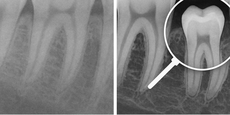 Dentistas digitales en México: planificación 3D para implantes más precisos y mejor diagnóstico
