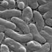 Alertan por la presencia de una bacteria carnívora en costas de Louisiana; aumentan los casos