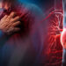 Detectar la aterosclerosis a tiempo puede prevenir un infarto